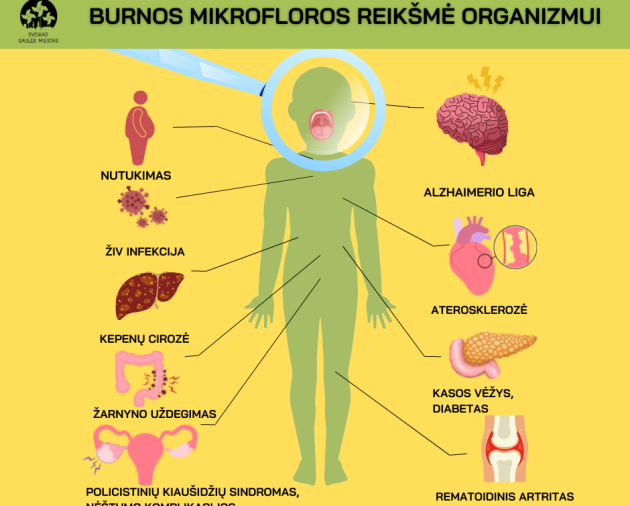 Rūpindamiesi burnos sveikata galite išvengti diabeto bei kitų ligų